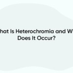 What Is Heterochromia and Why Does It Occur?