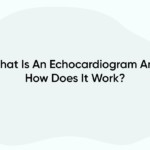 What Is An Echocardiogram And How Does It Work?