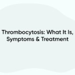 Thrombocytosis: What It Is, Symptoms & Treatment
