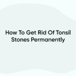 How To Get Rid Of Tonsil Stones Permanently