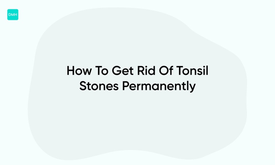 How To Get Rid Of Tonsil Stones Permanently
