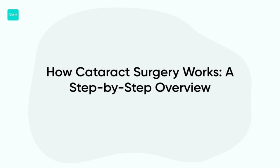 How Cataract Surgery Works: A Step-by-Step Overview