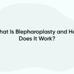 What Is Blepharoplasty and How Does It Work?