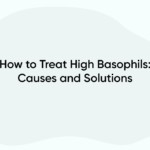 How to Treat High Basophils: Causes and Solutions