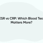 ESR vs CRP: Which Blood Test Matters More?