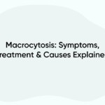 Macrocytosis: Symptoms, Treatment & Causes Explained