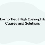 How to Treat High Eosinophils: Causes and Solutions