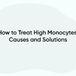 How to Treat High Monocytes: Causes and Solutions