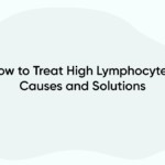 How to Treat High Lymphocytes: Causes and Solutions