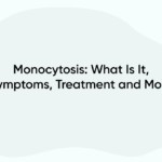 Monocytosis: What Is It, Symptoms, Treatment and More